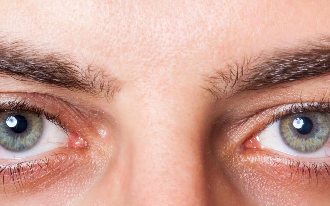 Problemas en los ojos (e irritación, conjuntivitis y ojeras): Significado espiritual —Completo—